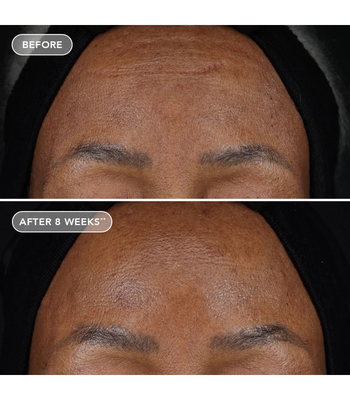 Посилений крем з ретиноловим комплексом 1.2% Image Skincare Ageless+ Retinol Treatment Crème 1.2% Retinol Complex